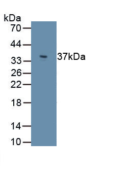 Perilipin 3 (PLIN3) Polyclonal Antibody, CAU31729