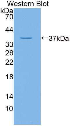 Gibbon Ape Leukemia Virus Receptor 1 (GLVR1) Polyclonal Antibody, CAU31742