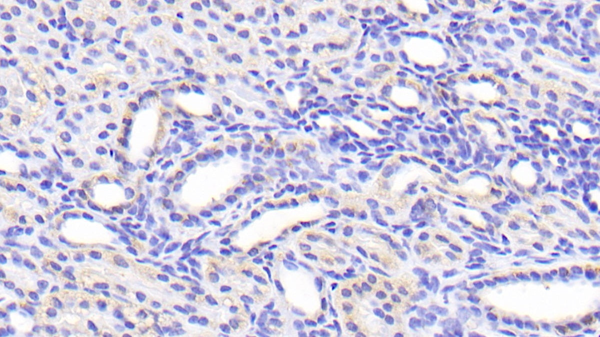 DAB staining on IHC-P; Samples: Human Kidney Tissue; Primary Ab: 20μg/ml Rabbit Anti-Human SLC39A7 Antibody Second Ab: 2µg/mL HRP-Linked Caprine Anti-Rabbit IgG Polyclonal Antibody