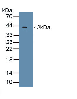 B-Cell CLL/Lymphoma 7A (Bcl7A) Polyclonal Antibody, CAU31746