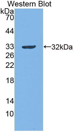 Guanylate Binding Protein 6 (GBP6) Polyclonal Antibody, CAU31749