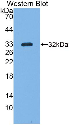 Guanylate Binding Protein 5 (GBP5) Polyclonal Antibody, CAU31750