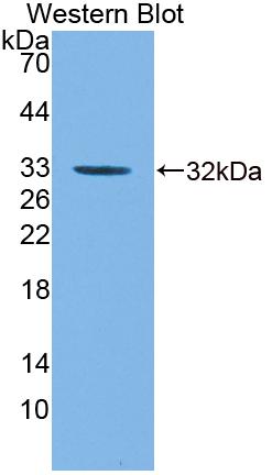 Guanylate Binding Protein 5 (GBP5) Polyclonal Antibody, CAU31751