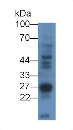 Receptor Interacting Serine Threonine Kinase 3 (RIPK3) Polyclonal Antibody, CAU31754