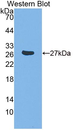 Minichromosome Maintenance Deficient 3 (MCM3) Polyclonal Antibody, CAU31755