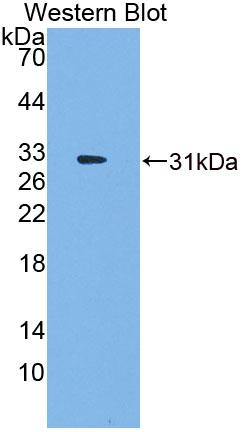 Cell Division Cycle Protein 7 (CDC7) Polyclonal Antibody, CAU31757