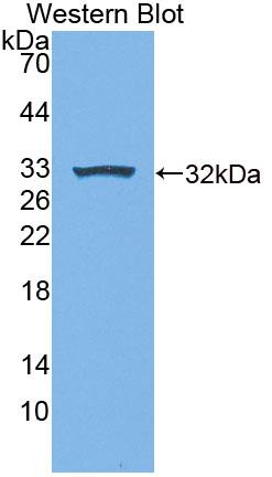 Ubiquitin Conjugating Enzyme E2S (UBE2S) Polyclonal Antibody, CAU31760