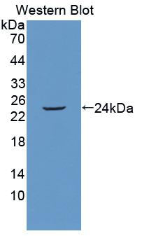 FK506 Binding Protein 7 (FKBP7) Polyclonal Antibody, CAU31765