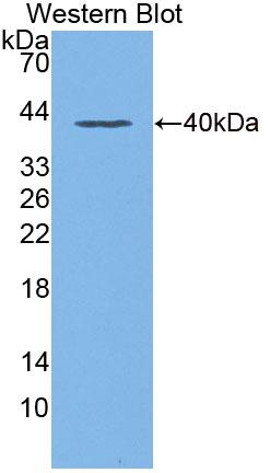 Uridine Phosphorylase 2 (UPP2) Polyclonal Antibody, CAU31767