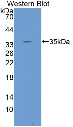 Eukaryotic Translation Initiation Factor 4A1 (EIF4A1) Polyclonal Antibody, CAU31779