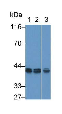Eukaryotic Translation Elongation Factor 1 Delta (EEF1d) Polyclonal Antibody, CAU31784