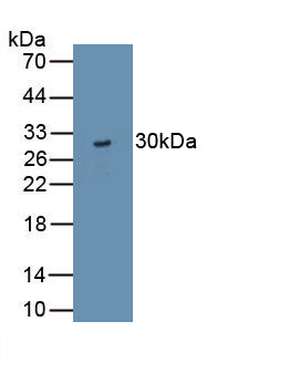 Tight Junction Protein 3 (TJP3) Polyclonal Antibody, CAU31801