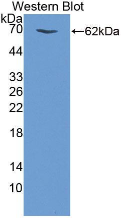Phosphodiesterase 3A, cGMP Inhibited (PDE3A) Polyclonal Antibody, CAU31825