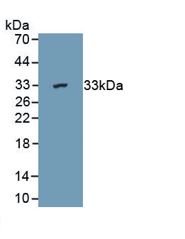 Aspartyl tRNA Synthetase 2, Mitochondrial (DARS2) Polyclonal Antibody, CAU31833