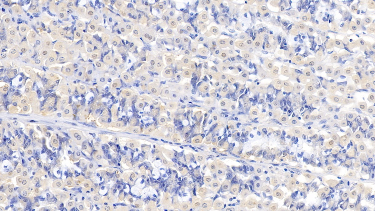 DAB staining on IHC-P; Samples: Human Stomach Tissue; Primary Ab: 10µg/ml Rabbit Anti-Human ASPH Antibody Second Ab: 2µg/mL HRP-Linked Caprine Anti-Rabbit IgG Polyclonal Antibody