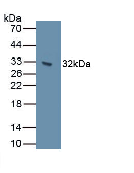 Cadherin 7 (CDH7) Polyclonal Antibody, CAU31842