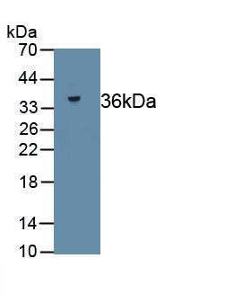 Reticulocalbin 2 (RCN2) Polyclonal Antibody, CAU31863