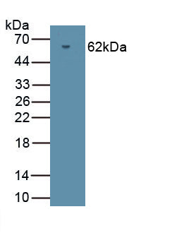 Protein Kinase, cGMP Dependent Type II (PRKG2) Polyclonal Antibody, CAU31865