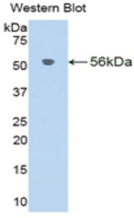 Klotho Beta (KLb) Polyclonal Antibody, CAU31870