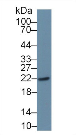 Parkinson Disease Protein 7 (PARK7) Polyclonal Antibody, CAU31886