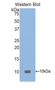 Fibronectin Type III Domain Containing Protein 5 (FNDC5) Polyclonal Antibody, CAU31899