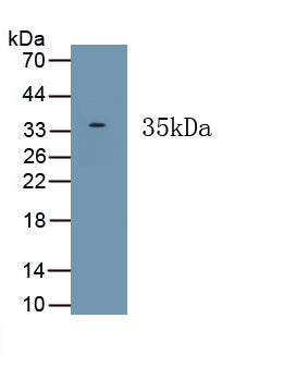 Hermansky Pudlak Syndrome Protein 6 (HPS6) Polyclonal Antibody, CAU31901