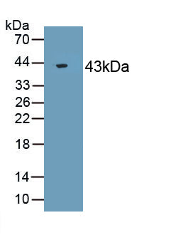 Actin (ACTIN) Polyclonal Antibody, CAU31928