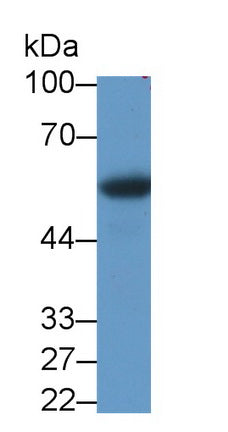 Programmed Cell Death Protein 1 (PD1) Monoclonal Antibody, CAU32012