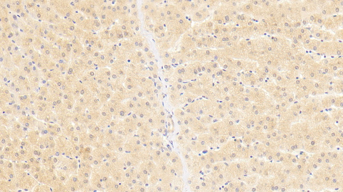 DAB staining on IHC-P; Sample: Human Liver Tissue; Primary Ab: 30ug/ml Mouse Anti-Human OAS1 Antibody Second Ab: 2ug/mL HRP-Linked Caprine Anti-Mouse IgG Polyclonal Antibody