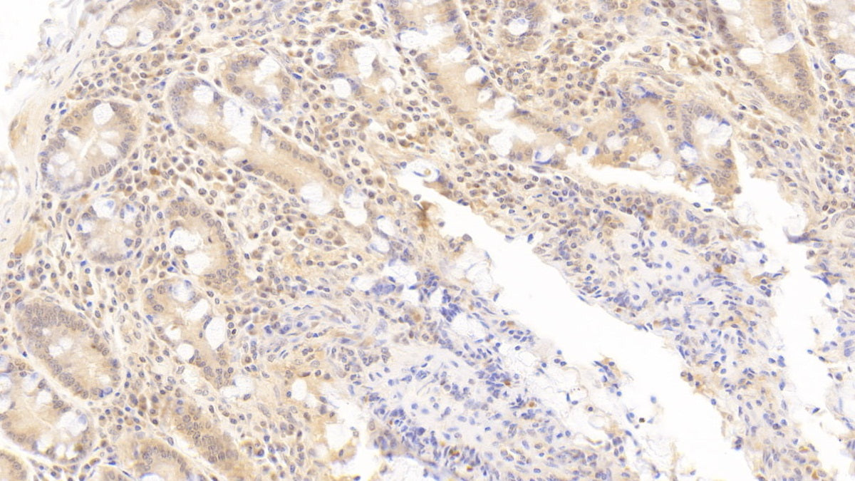DAB staining on IHC-P; Sample: Human Small intestine Tissue; Primary Ab: 30ug/ml Mouse Anti-Human OAS1 Antibody Second Ab: 2ug/mL HRP-Linked Caprine Anti-Mouse IgG Polyclonal Antibody