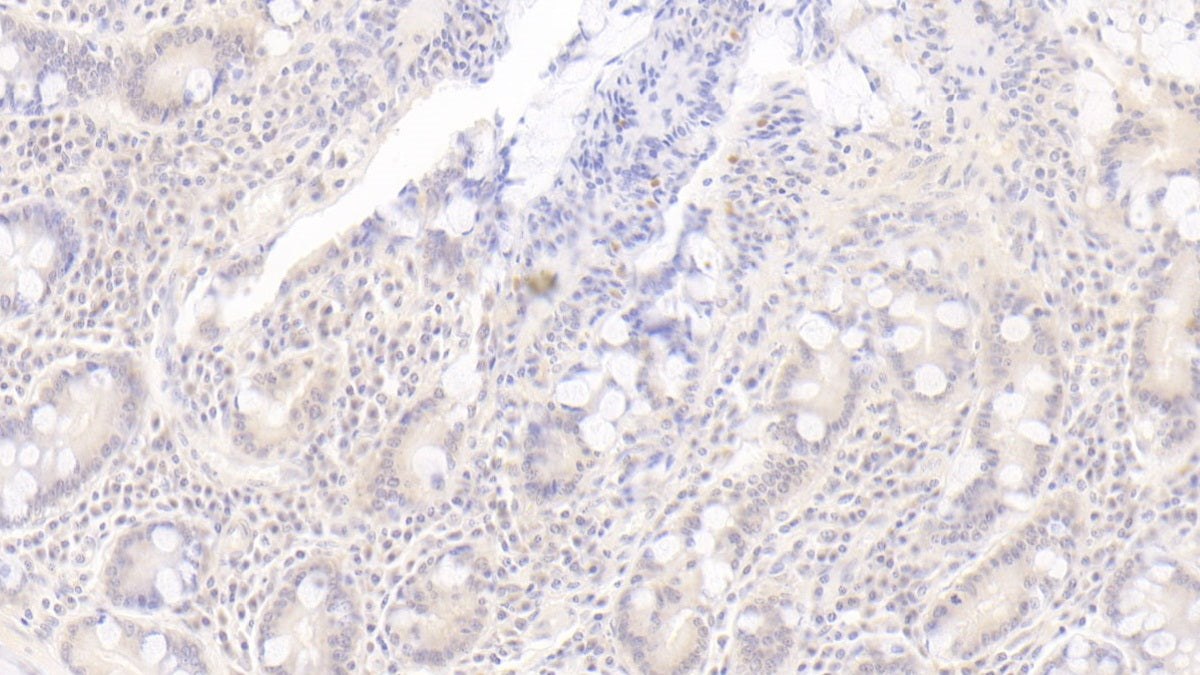 DAB staining on IHC-P; Sample: Human Small intestine Tissue; Primary Ab: 30ug/ml Mouse Anti-Human OAS1 Antibody Second Ab: 2ug/mL HRP-Linked Caprine Anti-Mouse IgG Polyclonal Antibody