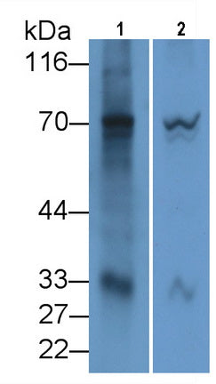 Western Blot; Sample: Lane1: Human Lung lysate; Lane2: Jurkat cell lysate Primary Ab: 3ug/ml Mouse Anti-Human OAS2 Antibody Second Ab: 0.2ug/mL HRP-Linked Rabbit Anti-Mouse IgG Polyclonal Antibody