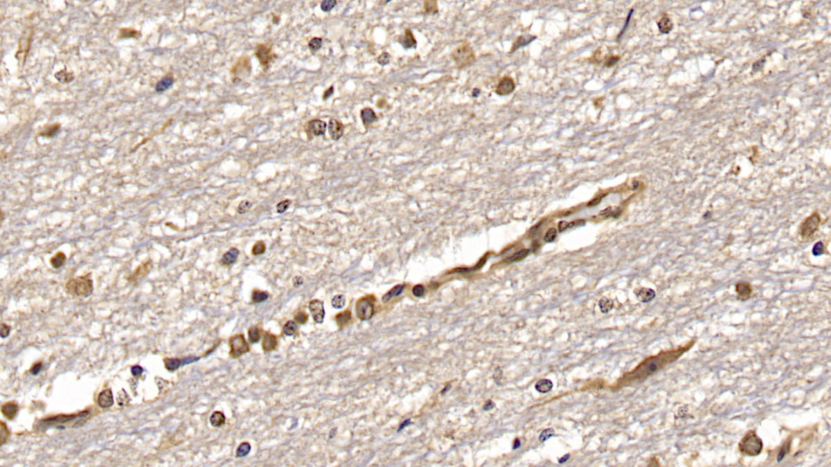 DAB staining on IHC-P; Samples: Human Cerebrum Tissue; Primary Ab: 40ug/ml Mouse Anti-Human OAS2 Antibody Second Ab: 2ug/mL HRP-Linked Caprine Anti-Mouse IgG Polyclonal Antibody