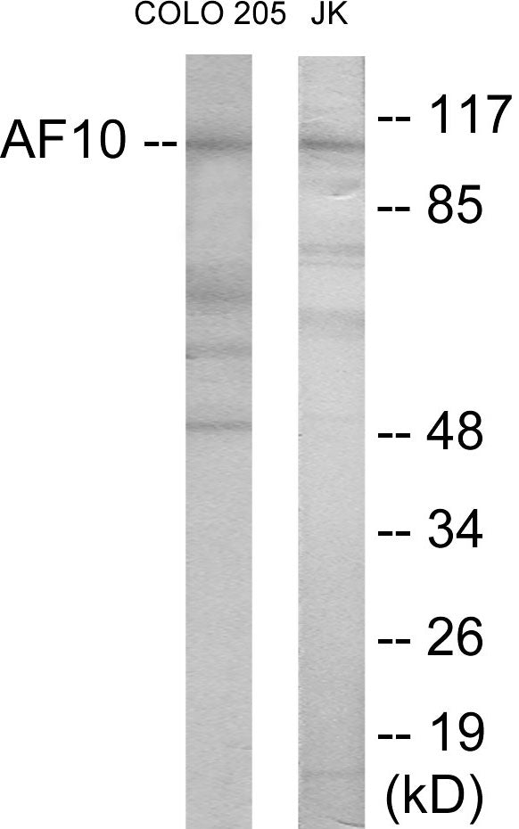 Western blot analysis of extracts from COLO205/Jurkat cells, using AF10 Antibody. The lane on the right is treated with the synthesized peptide.