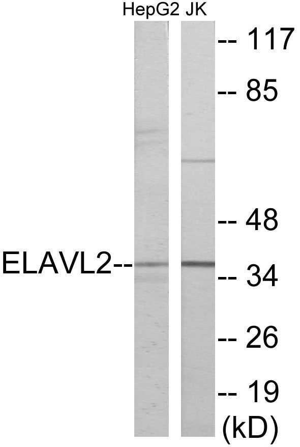 Western blot analysis of extracts from HepG2/Jurkat cells, using ELAVL2 Antibody. The lane on the right is treated with the synthesized peptide.