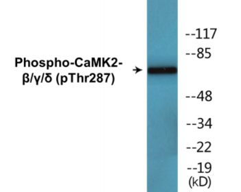 Phospho-CaMK2-B Beta/G Gamma/D Delta (Thr287) ELISA Kit