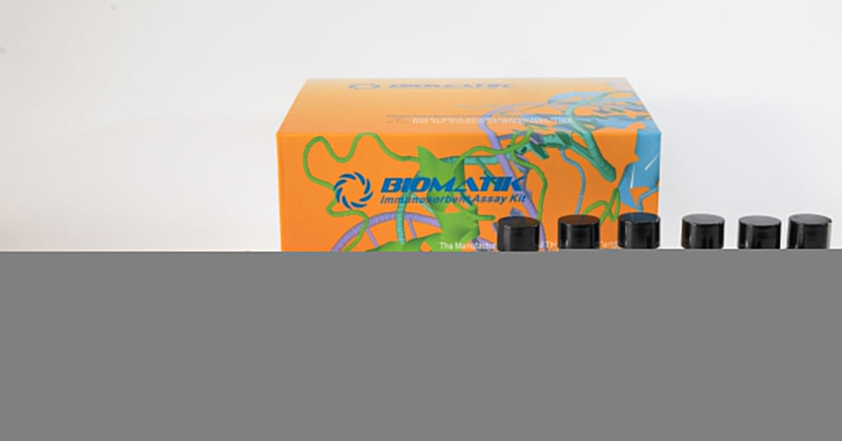Human TTR (Transthyretin) Rapid ELISA Kit, Cat#EKR06533