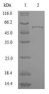 Recombinant Human Heterogeneous nuclear ribonucleoproteins A2/B1 (HNRNPA2B1)
