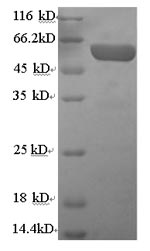 Recombinant Human Serum paraoxonase/arylesterase 1 (PON1)