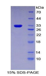 Recombinant Rat Interferon Alpha/Beta Receptor 1 (IFNa/bR1)