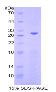Recombinant Mouse Serum/Glucocorticoid Regulated Kinase 3 (SGK3)