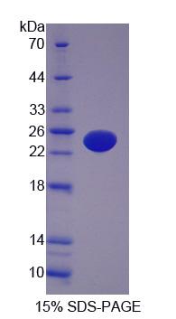 Recombinant Human AF4/FMR2 Family, Member 1 (AFF1)