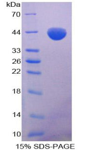 Recombinant Pig Monocyte Chemotactic Protein 1 (MCP1)