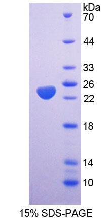 Recombinant Rat Spermidine/Spermine N1-Acetyltransferase 1 (SAT1)