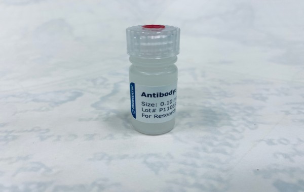 Angiopoietin 4 (Angpt4) Polyclonal Antibody, Cat#CAU27413